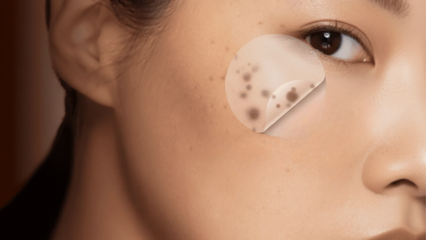 撕」出好膚質！Reepot AI時光雷射效果與價格全解析